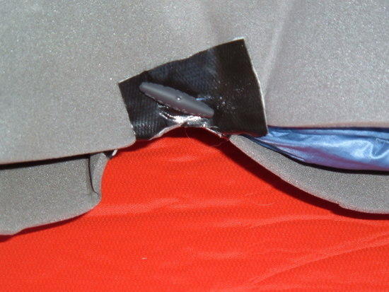 This picture shows the toggle closure