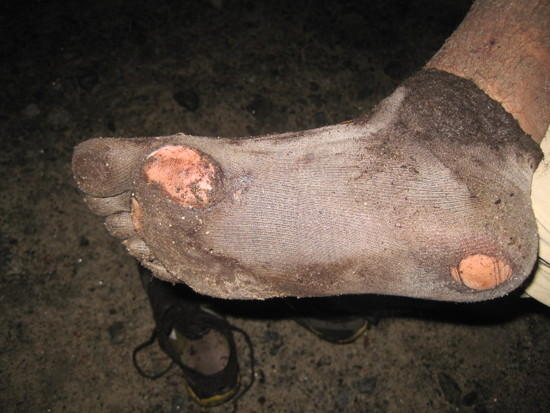 socks
