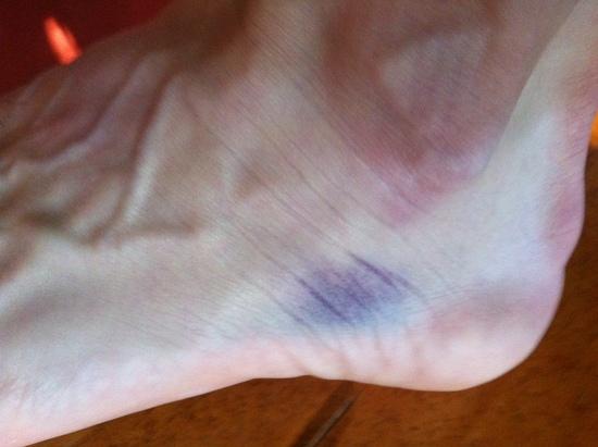 Blue Foot