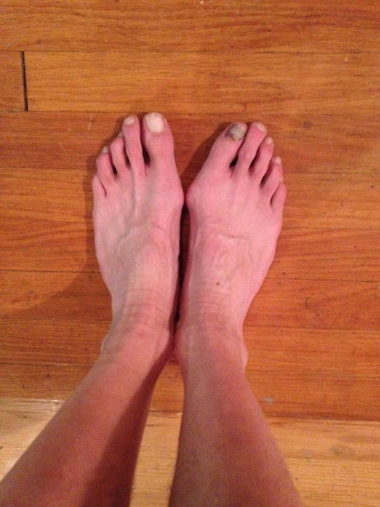 Feet