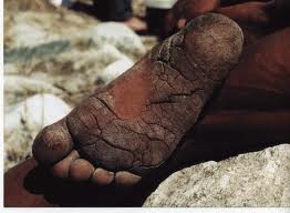 barefoot Porter