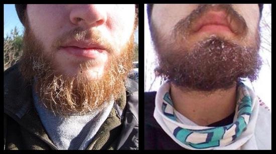 Our beards has ice build up in them!