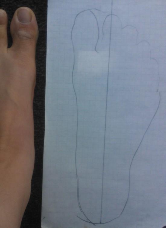 foot shape