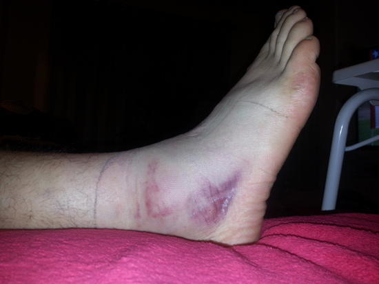 ankle