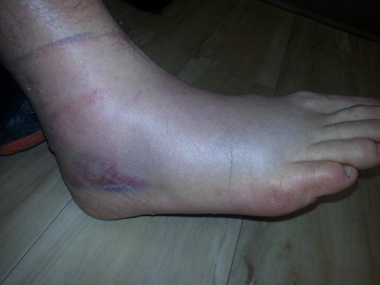 ankle