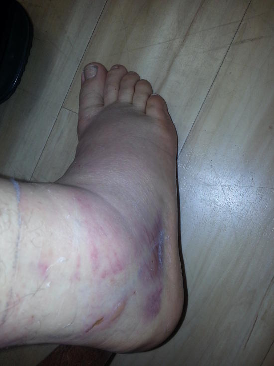 ankle