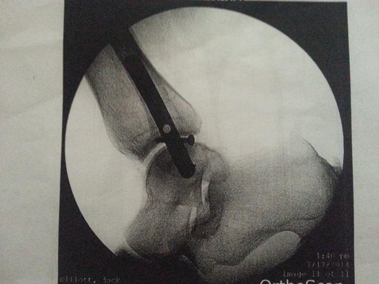 ankle