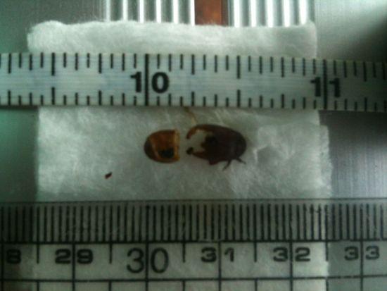 bug in ear