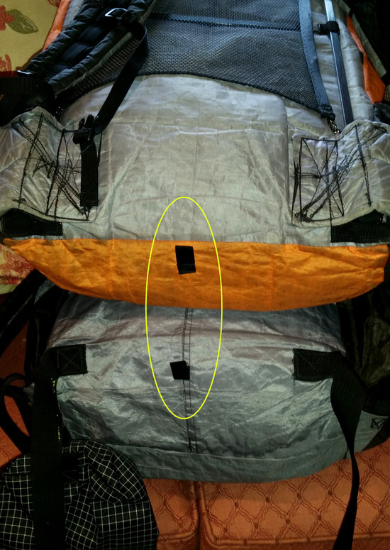 lumbar loops